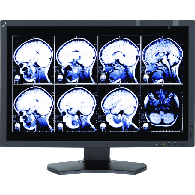 NEC Display 24" Medical Review Display with Front Sensor (FDA Pending) MD242C2
