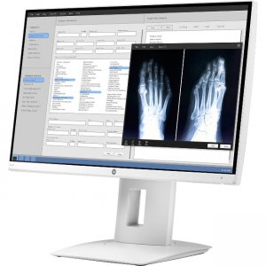 HP 24-inch Healthcare Edition Display (Z0A71A4) Z0A71A4#ABA HC240